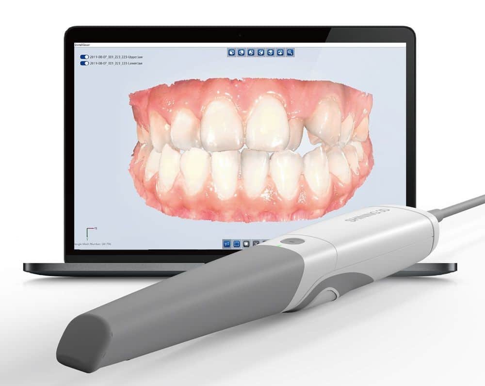 3D-Dental-Imaging-Intraoral-Scanning-Mint-Mini-Dental-Implants - Daniela Ordoñez Dental Partners - Issue 47